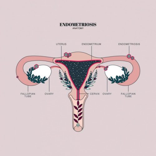 endometriosis.pms_.periods.hormones